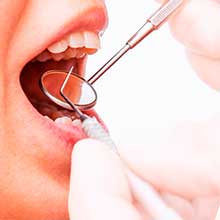 歯のメンテナンスの受診率が低い日本