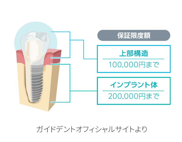 10年保証システム